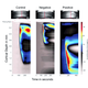 On the left, the optical images shows the wave of spreading depolarization in the brain; in the middle, the image shows the speeding up and drawing to the surface of the wave with negative current; and on the right, the image shows the confinement of the wave with arrest of the propagation, right.